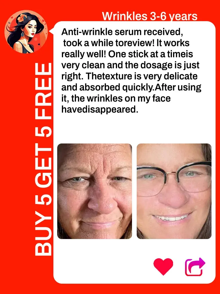 removes wrinkles,anti wrinkle serum