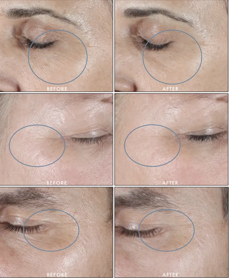 SkinMedica HA5 Rejuvenating Hydrator